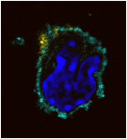 A dendritic cell at an irradiated tumor, dressed in tumor antigen